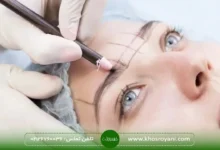 کاشت ابرو سعادت آباد