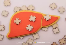 Treatment of fatty liver