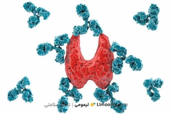 غذا  برای هاشیموتو