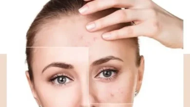 پاکسازی پوست چرب و جوش دار با سالن زیبایی شبنم نظیف