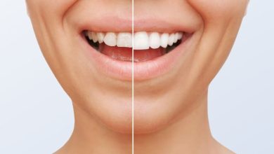کامپوزیت دندان برای چه افرادی مناسب نیست؟