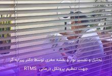 درمان افسردگی با rtms