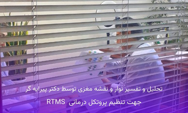 درمان افسردگی با rtms