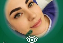 عمل چشم آهویی