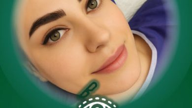 عمل چشم آهویی