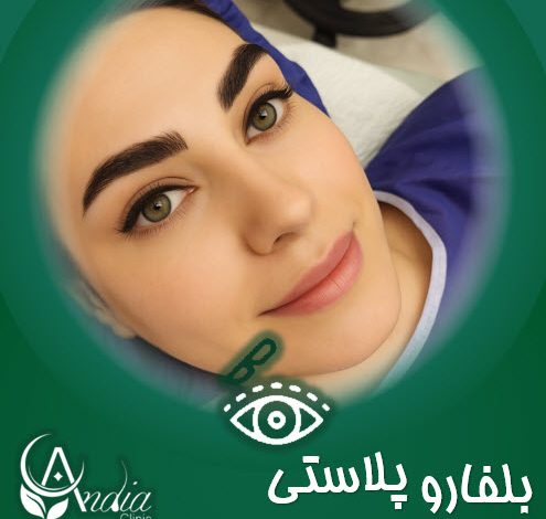 عمل چشم آهویی